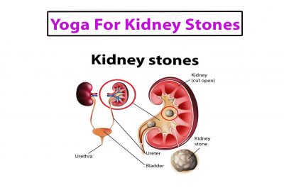 Yoga For Kidney Stone